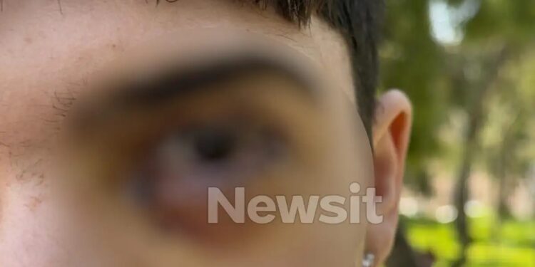 Ξυλοδαρμός στα Ιωάννινα: 17 ράμματα στο μάτι έκανε ο 16χρονος – «Τον χτύπησαν με μίσος, έχει υποστεί βλάβη»